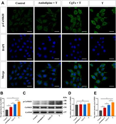 CaMKII is a modulator in neurodegenerative diseases and mediates the effect of androgen on synaptic protein PSD95